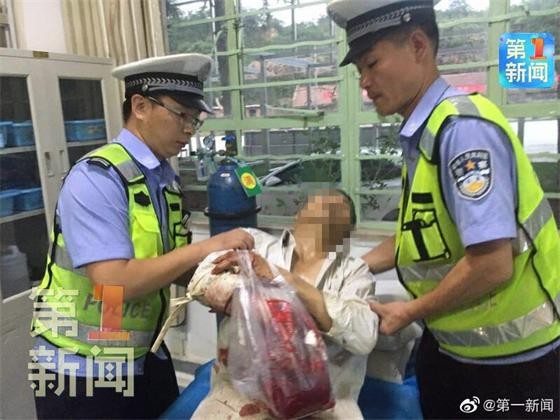 五指離斷男子已經治愈出院